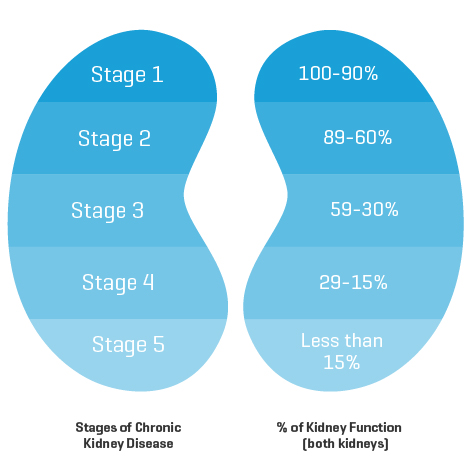 Diagram of the stages of chronic kidney disease
