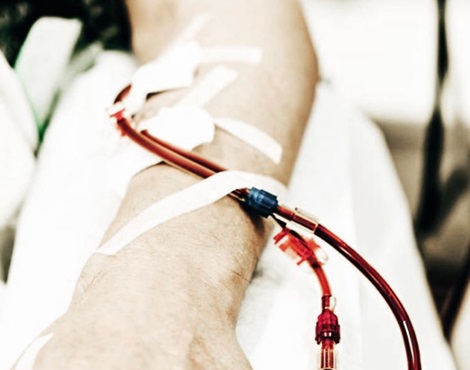 blood tubes in arm during dialysis